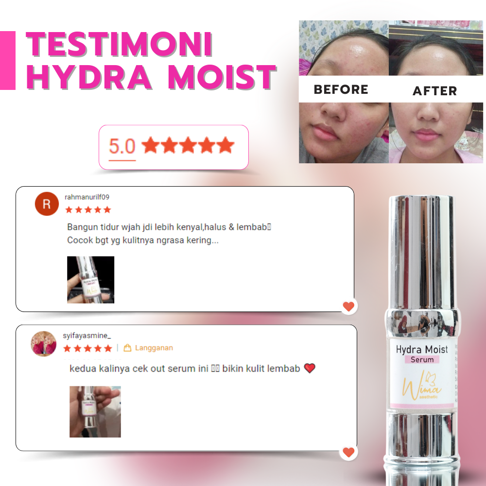 Hidra Moist Serum - Testimoni
