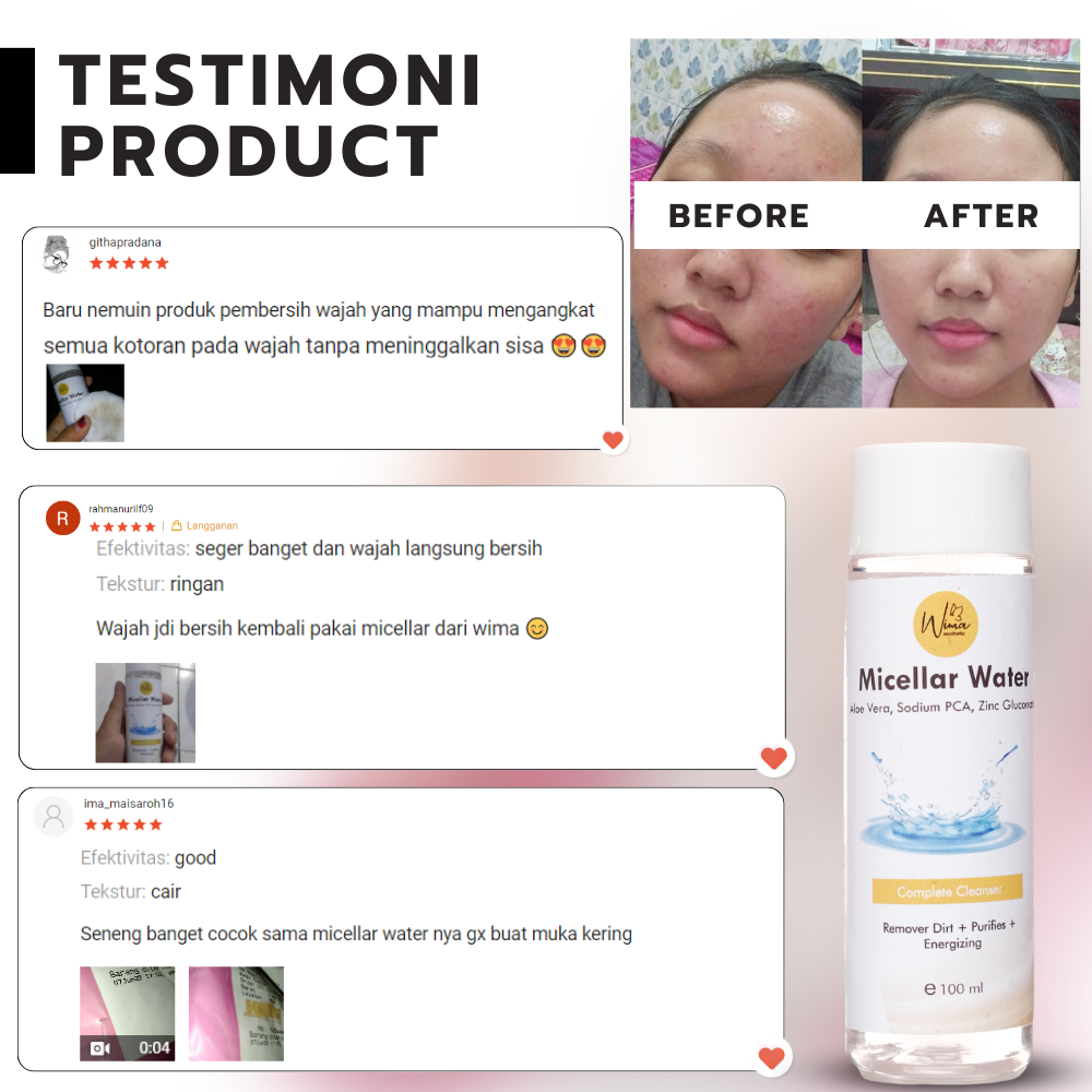 Micellar Water Wima Aesthetic